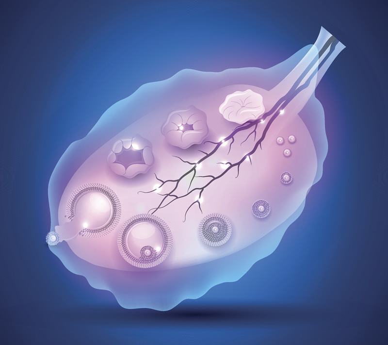 试管婴儿可能与罕见的眼肿瘤有关吗？